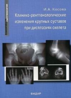 Клинико-рентгенологические изменения крупных суставов при дисплазиях скелета артикул 2798c.