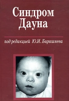 Синдром Дауна артикул 2849c.