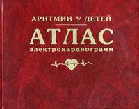 Аритмии у детей Атлас электрокардиограмм артикул 2853c.